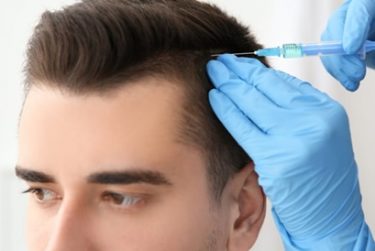 Điều trị rụng tóc ở nam giới cách nào hiệu quả?