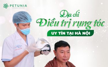 Địa chỉ điều trị rụng tóc uy tín tại Hà Nội